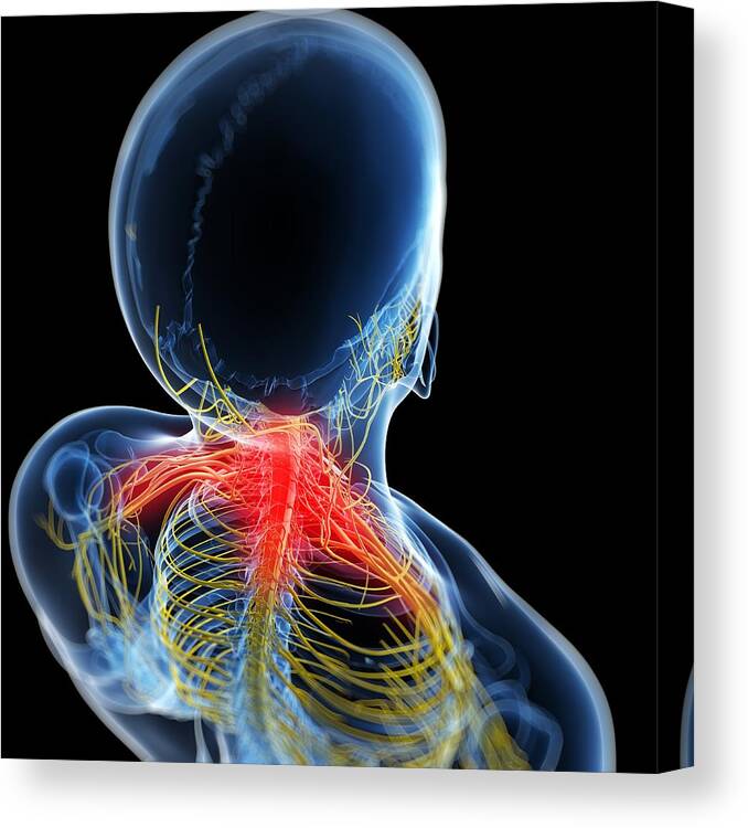 Square Canvas Print featuring the digital art Neck Pain, Conceptual Artwork #8 by Sciepro