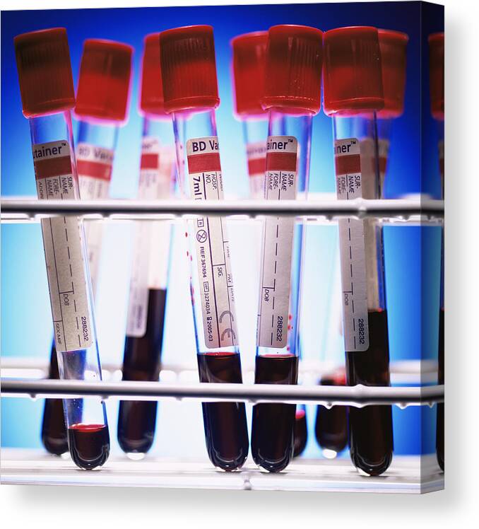 Rack Canvas Print featuring the photograph Blood Samples by Kevin Curtis