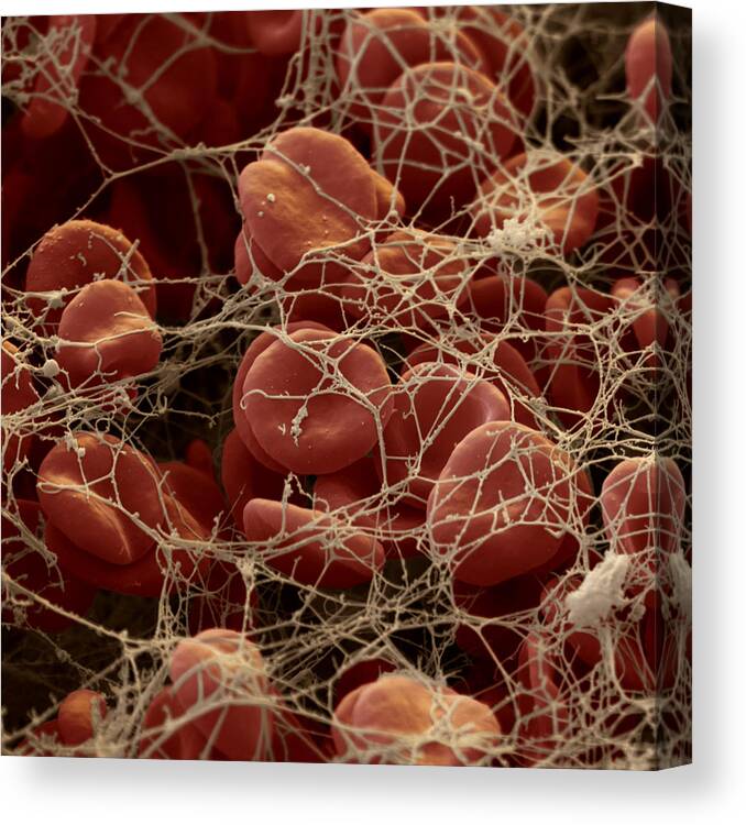 Blood Canvas Print featuring the photograph Blood Clot #1 by Oliver Meckes EYE OF SCIENCE