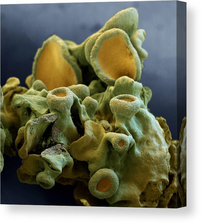 Algae Canvas Print featuring the photograph Common Orange Lichen #1 by Meckes/ottawa