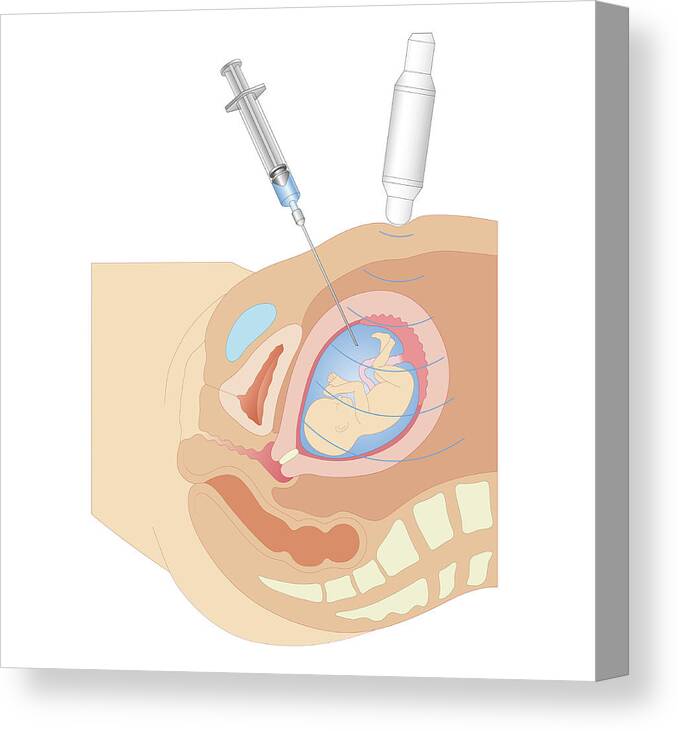 People Canvas Print featuring the digital art Cross Section Biomedical Illustration #1 by Dorling Kindersley