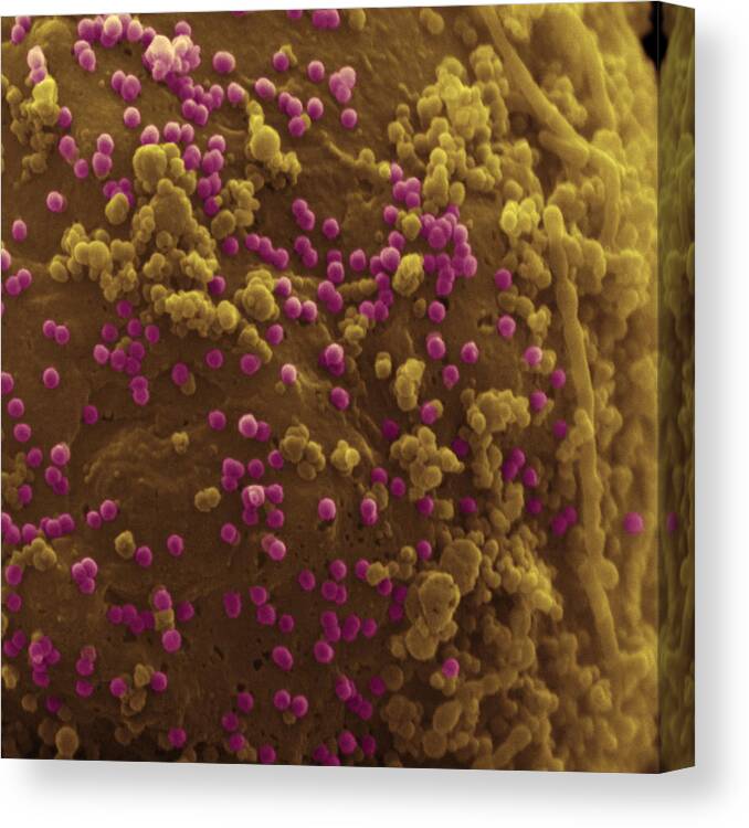 Acquired Immune Deficiency Syndrome Canvas Print featuring the photograph Hiv Viruses And Lymphocytes #1 by Meckes/ottawa