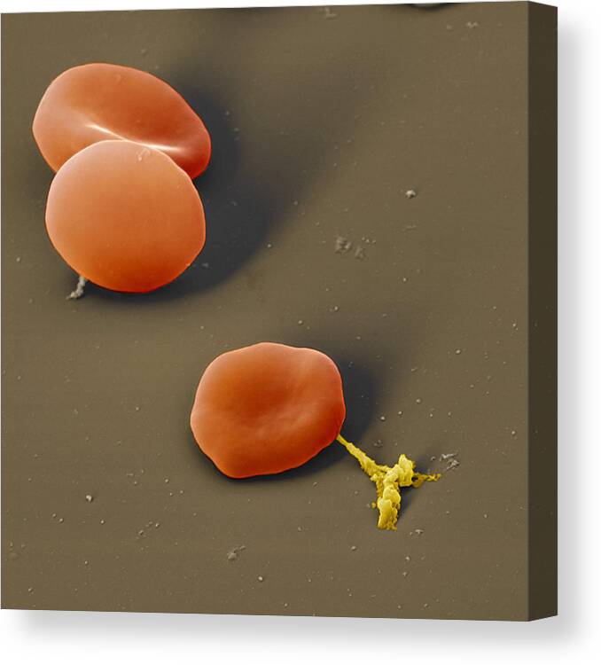 Blood Canvas Print featuring the photograph Blood Cells #12 by Meckes/ottawa