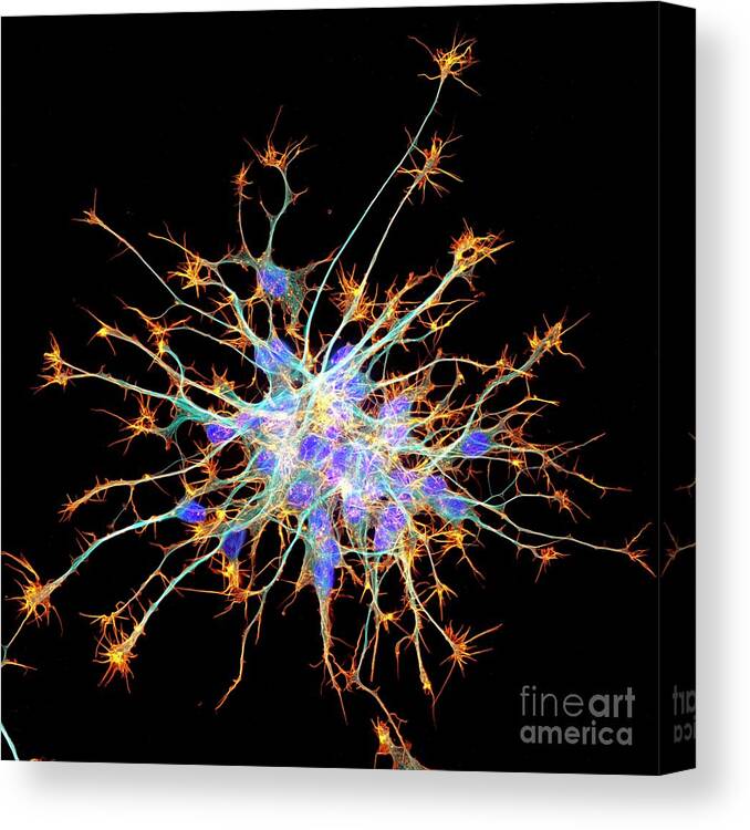 Actin Canvas Print featuring the photograph Neurons From Stem Cells #4 by Dr Torsten Wittmann/science Photo Library