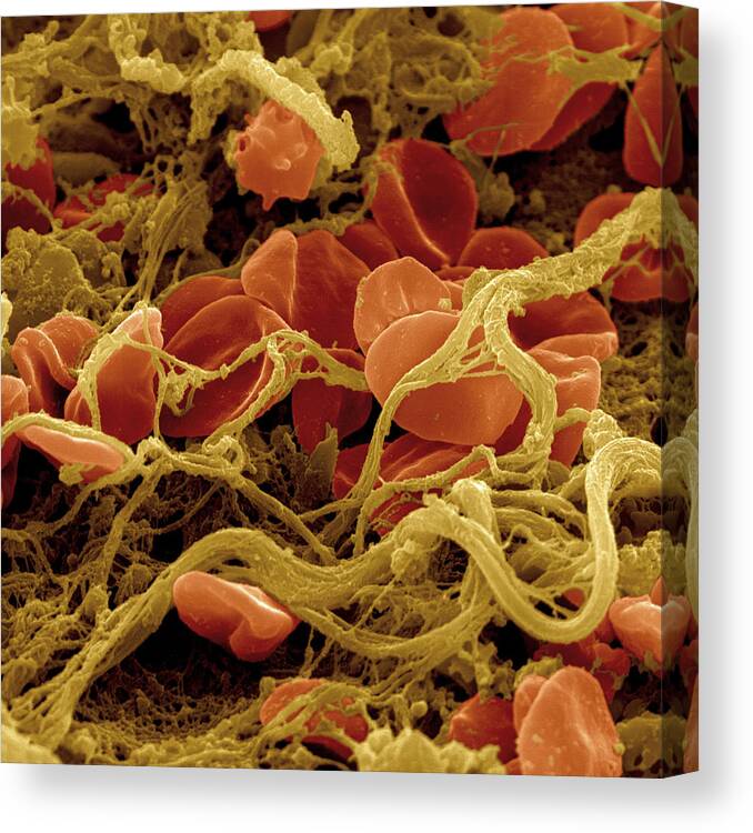 Blood Canvas Print featuring the photograph Erythrocytes And Fibrin Threads by Meckes/ottawa