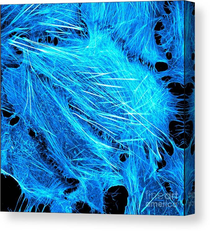 Cancer Canvas Print featuring the photograph Osteosarcoma Showing Actin Cytoskeleton by Howard Vindin, The University Of Sydney/science Photo Library