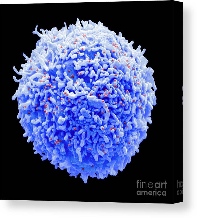 Aids Infection Canvas Print featuring the photograph T-cell Infected With Hiv by Steve Gschmeissner/science Photo Library