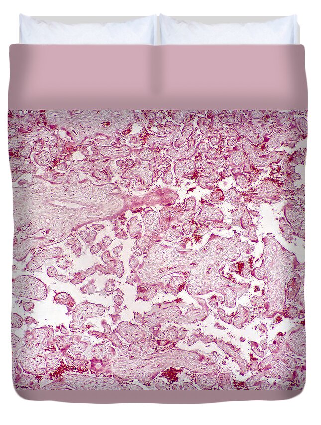 Horizontal Duvet Cover featuring the photograph Placenta Section, Lm #1 by Science Stock Photography