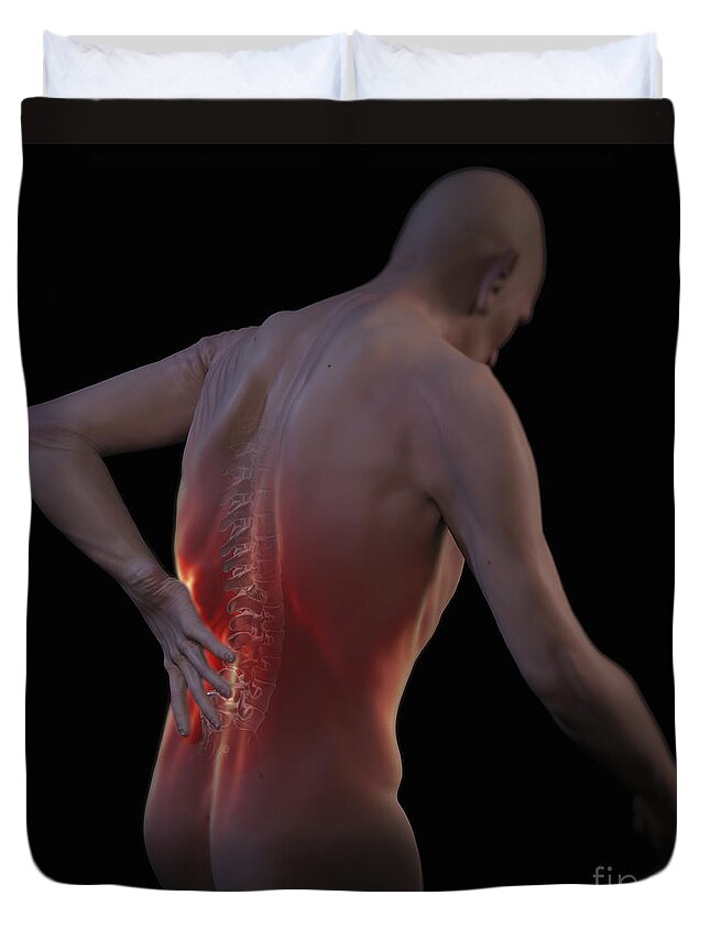Back Ache Duvet Cover featuring the photograph Back Pain #3 by Science Picture Co