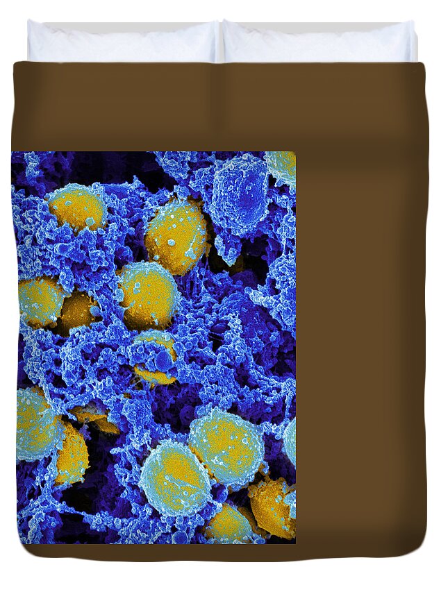 Staphylococcus Aureus Duvet Cover featuring the photograph Staphylococcus Aureus Bacteria Sem #5 by Science Source