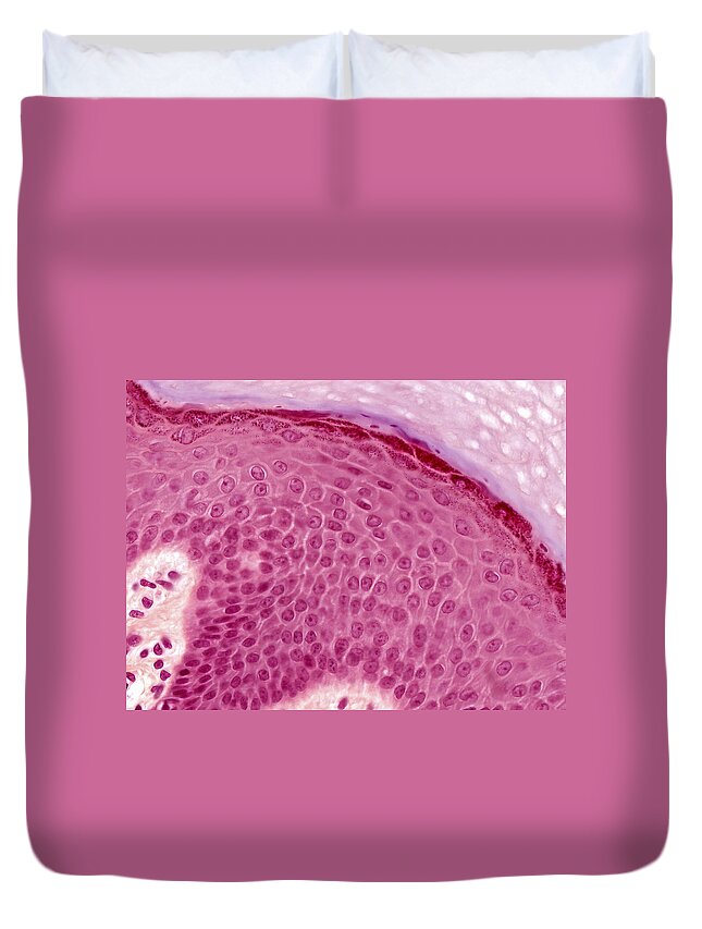 Skin Duvet Cover featuring the photograph Epidermis Lm by Alvin Telser