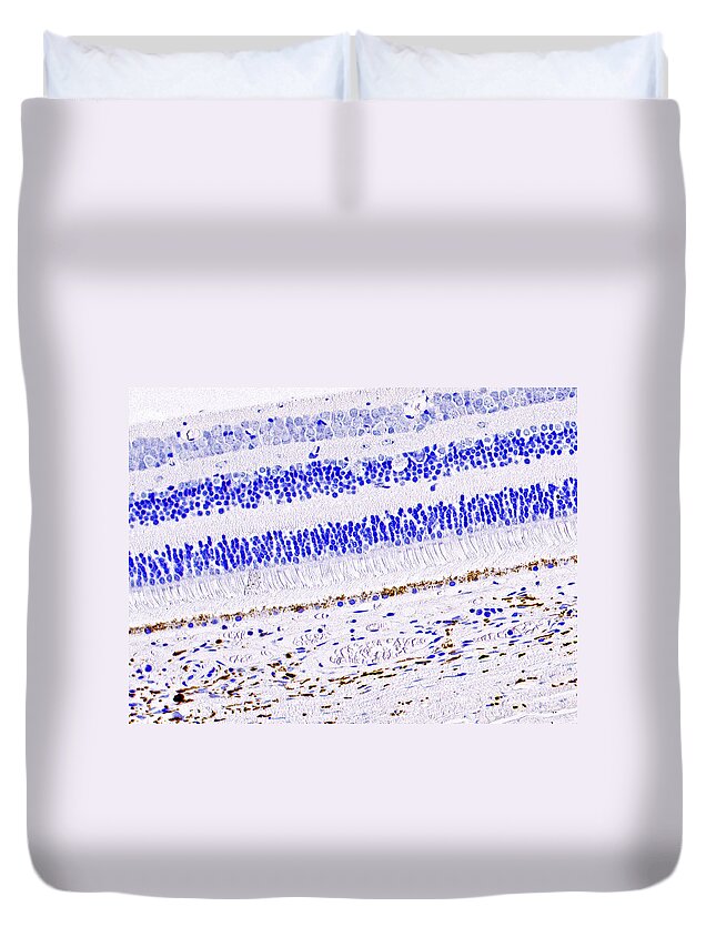 Eye Duvet Cover featuring the photograph Eye, Retina, Lm by Alvin Telser