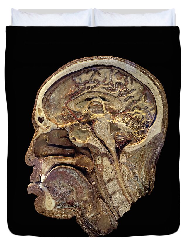 Science Duvet Cover featuring the photograph Human Head In Sagittal Section by Science Stock Photography