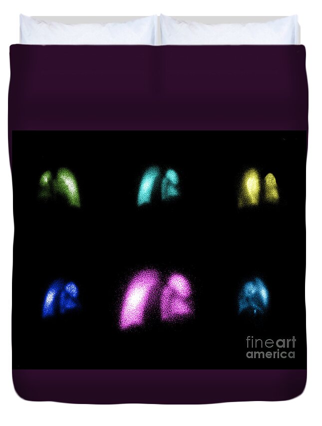 Nuclear Lung Scan Duvet Cover featuring the photograph Nuclear Medicine Lung Scan by Living Art Enterprises, LLC