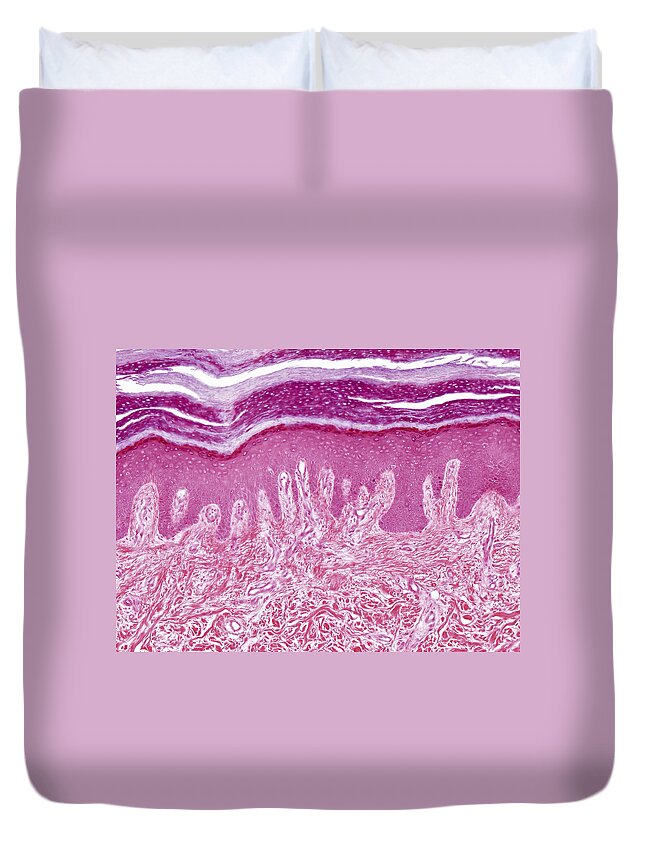 Skin Duvet Cover featuring the photograph Plantar Skin, Lm by Alvin Telser