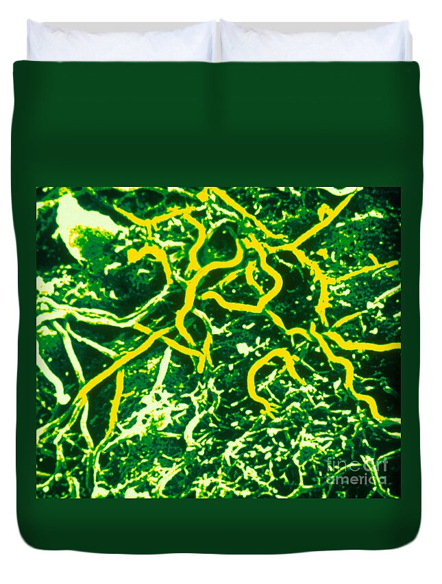 Tem Duvet Cover featuring the photograph Borrelia Burgdorferi #4 by Science Source