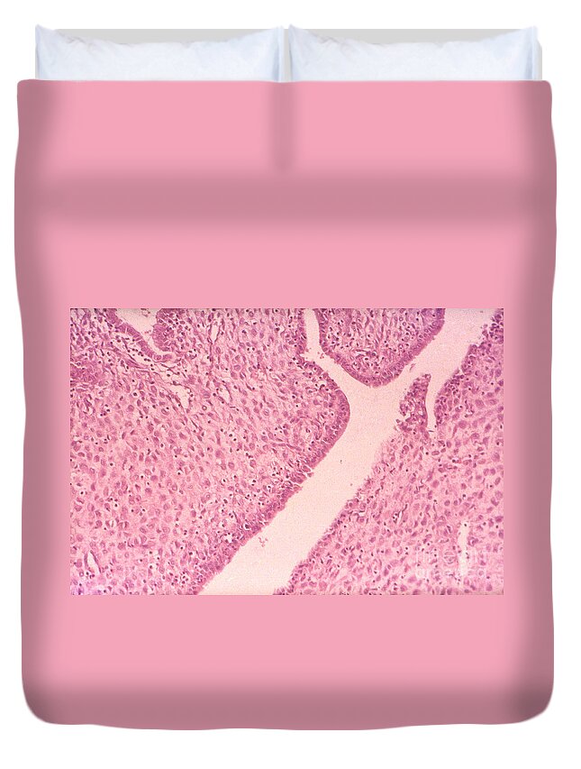 Science Duvet Cover featuring the photograph Decidual Cells Lm by M. I. Walker