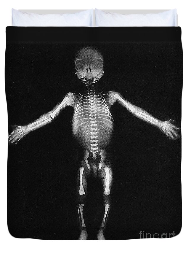 Skeleton Duvet Cover featuring the photograph Skeleton Of A Baby by Photo Researchers
