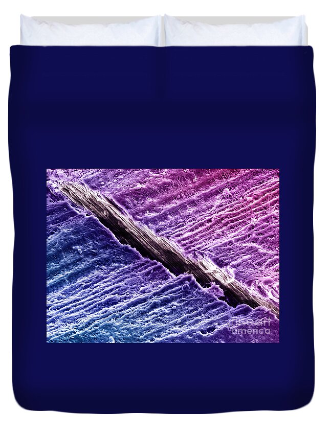 Dentine Duvet Cover featuring the photograph Human Tooth Dentine, Sem #4 by Ted Kinsman