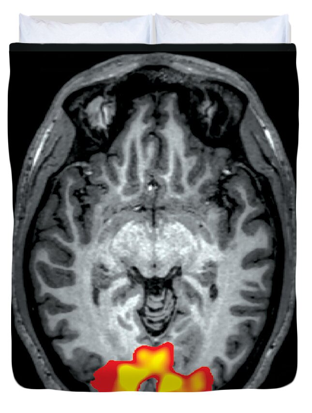 Fmri Duvet Cover featuring the photograph Fmri During Visual Stimulation by Living Art Enterprises
