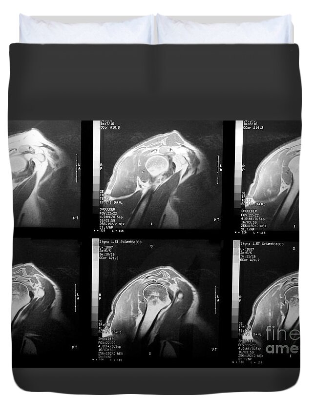 Rotator Cuff Duvet Cover featuring the photograph MRI of Rotator Cuff by Karen Foley