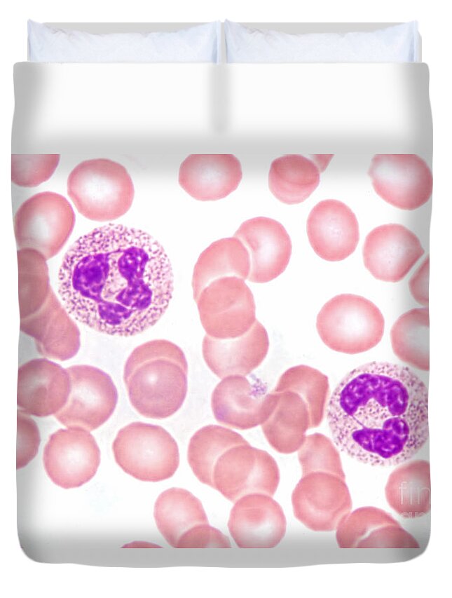 Neutrophil Polymorphs Duvet Cover featuring the photograph Neutrophils In Peripheral Blood Smear by M. I. Walker