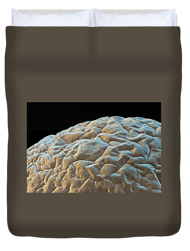 Chemistry Duvet Cover featuring the photograph Polyacrylic Acid Sem #1 by Meckes/ottawa