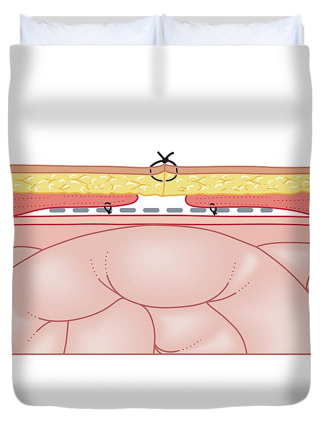 Problems Duvet Cover featuring the digital art Cross Section Biomedical Illustration #12 by Dorling Kindersley