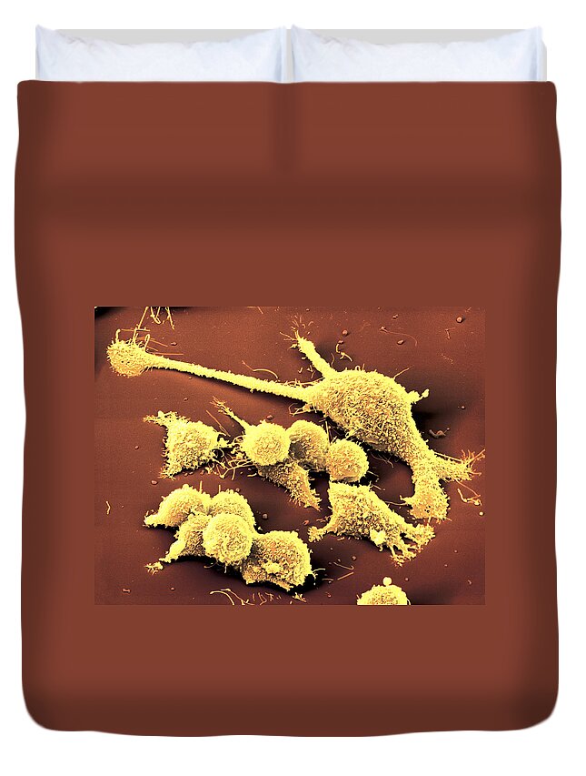 Cancer Duvet Cover featuring the photograph Intestinal Cancer Cells #2 by Meckes/ottawa