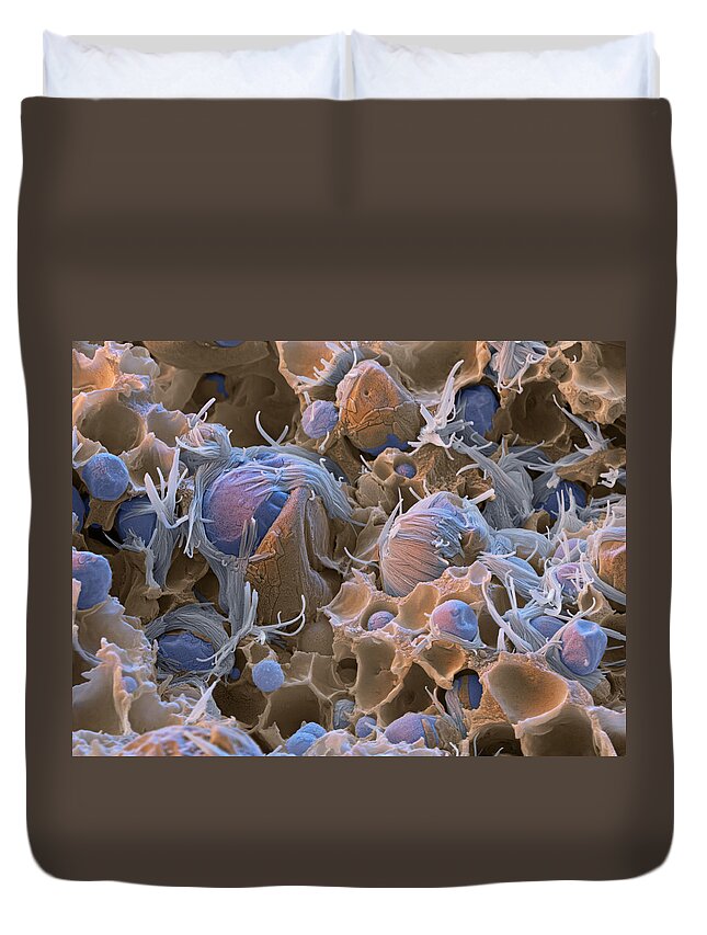 Chemistry Duvet Cover featuring the photograph Polyacrylic Acid Sem by Meckes/ottawa