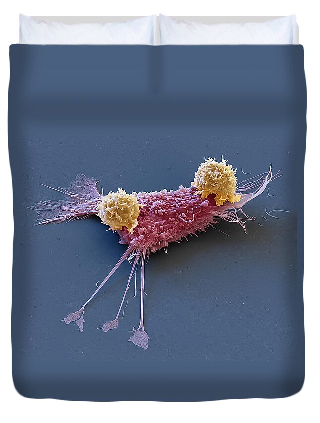 Adenocarcinoma Duvet Cover featuring the photograph Breast Cancer Cell With Car T-cells, Sem by Eye of Science