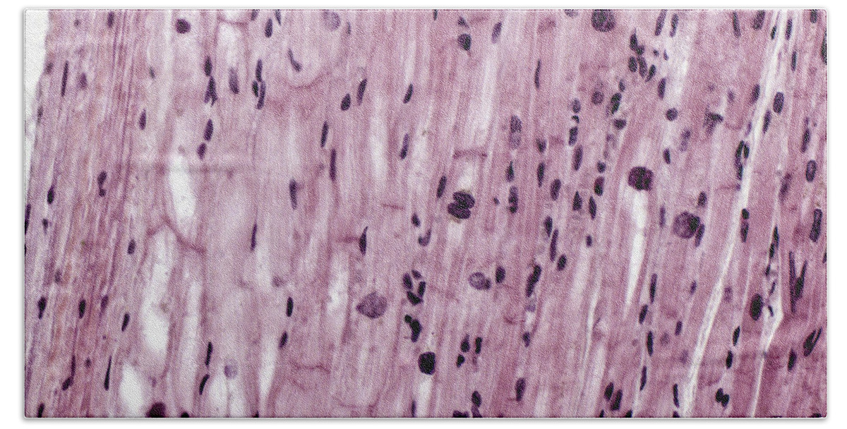 Cardiac Muscle Bath Towel featuring the photograph Cardiac Muscle With Purkinje Fibers, Lm #2 by Alvin Telser
