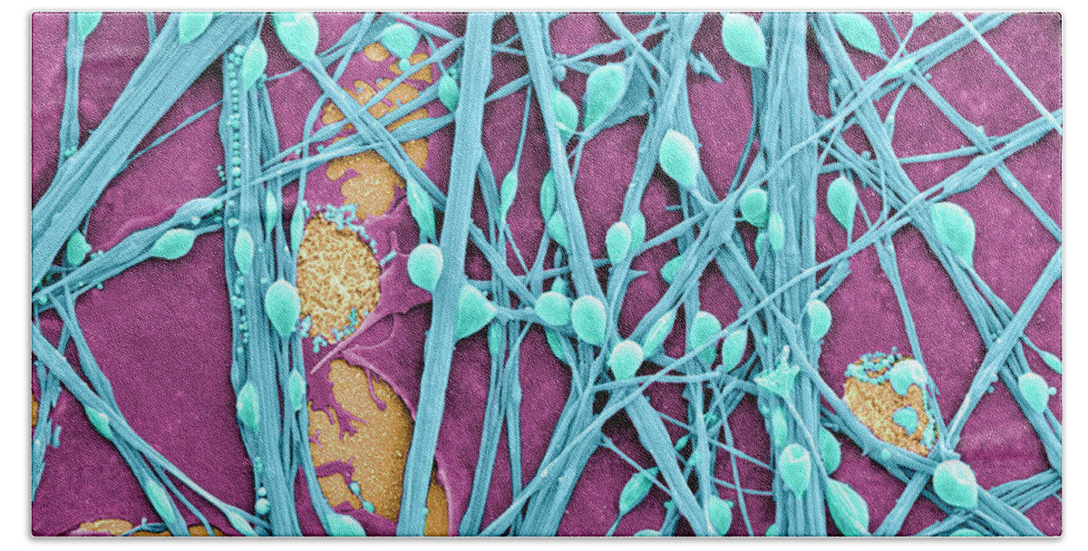 Science Hand Towel featuring the photograph Neurons And Glial Cells, Sem #1 by Science Source