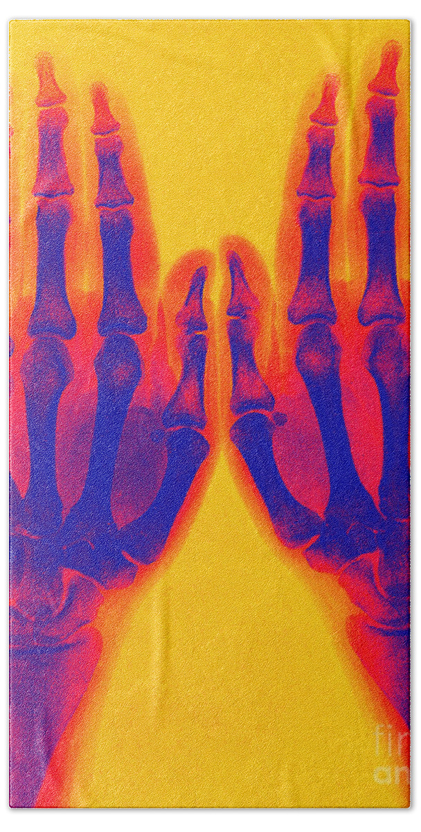 Historic Bath Towel featuring the photograph X-ray Of Two Normal Hands 1896 #3 by Science Source