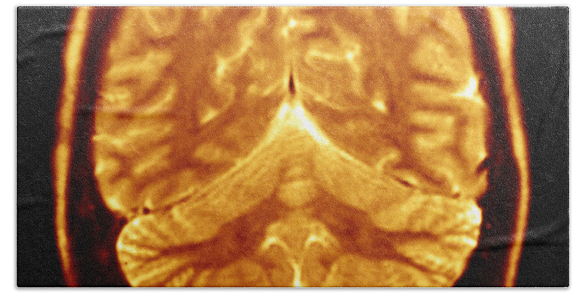 Radiology Bath Towel featuring the photograph Cerebral Mri by Scott Camazine