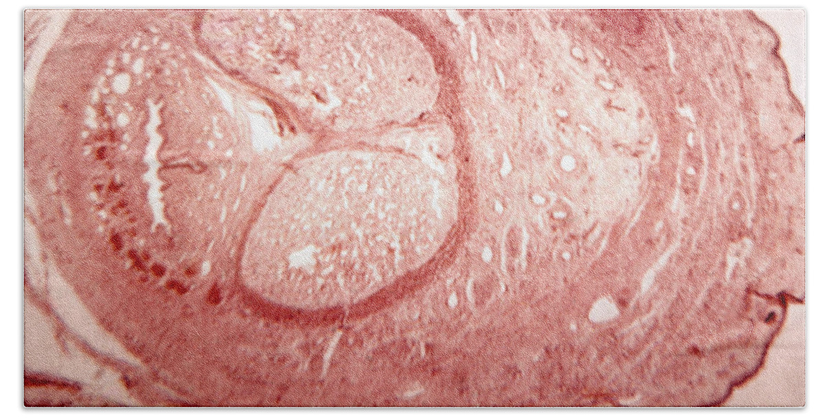 Corpus Spongiosum Bath Towel featuring the photograph Cross Section Of Fetal Penis, Lm by Biology Media