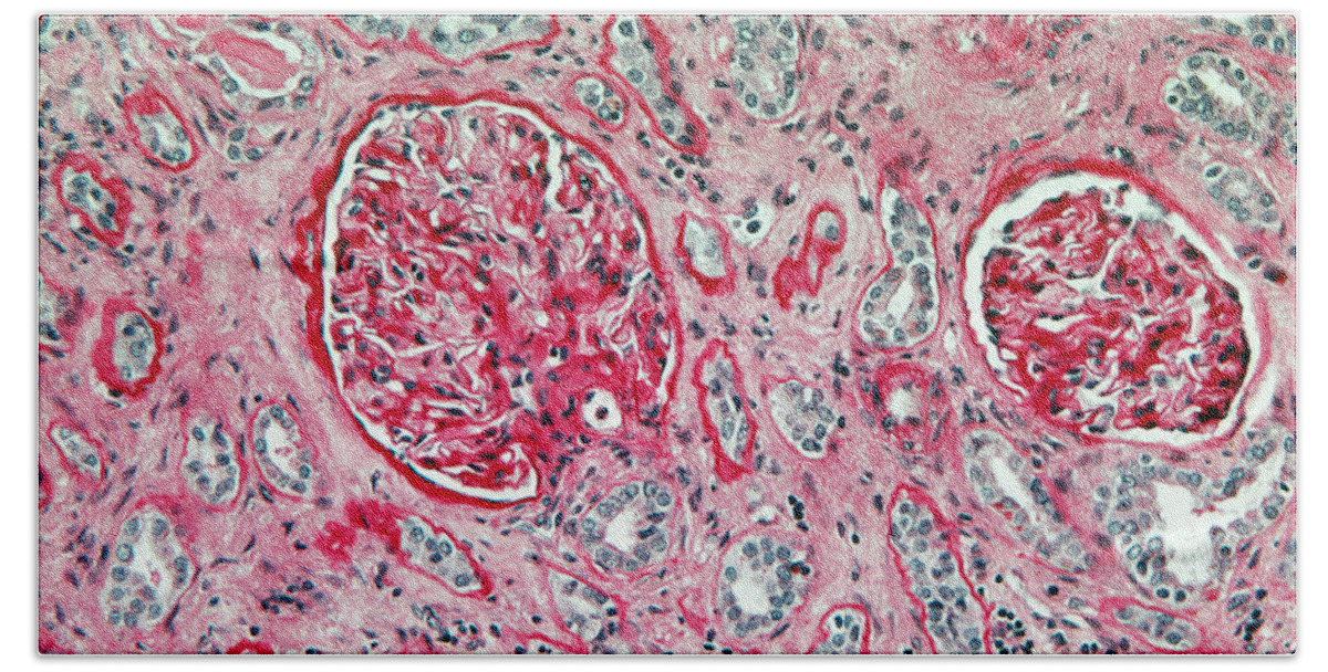 Bright Field Bath Towel featuring the photograph Lm Of Kidney Glomeruli by Michael Abbey