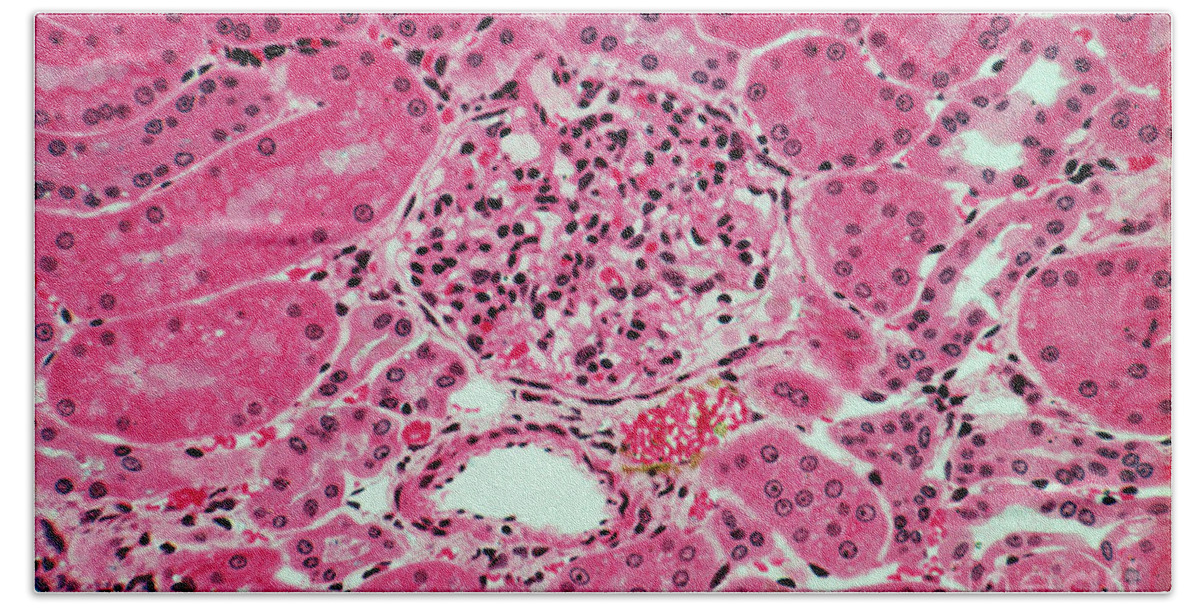 Cell Bath Towel featuring the photograph Lm Of Kidney Glomeruli #1 by M. I. Walker
