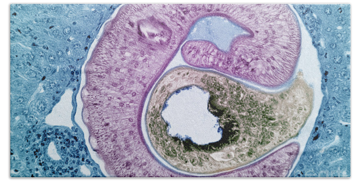 Pathology Hand Towel featuring the photograph Schistosoma Mansoni #1 by M. I. Walker