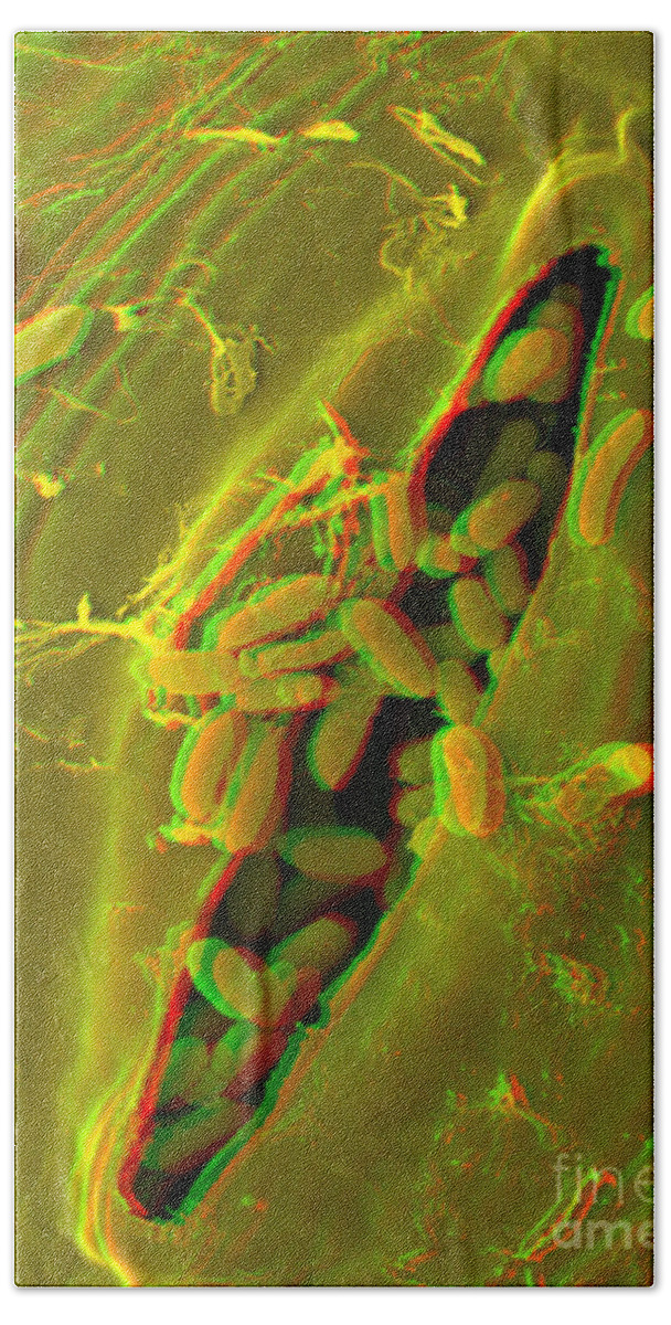 Anaglyph Hand Towel featuring the photograph Anaglyph Of Infected Lettuce Leaf #1 by Scimat