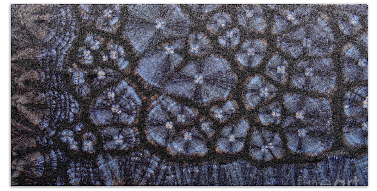 Atherosclerosis Bath Towel featuring the photograph Cholesterol Crystals, Polarized Lm #3 by Antonio Romero
