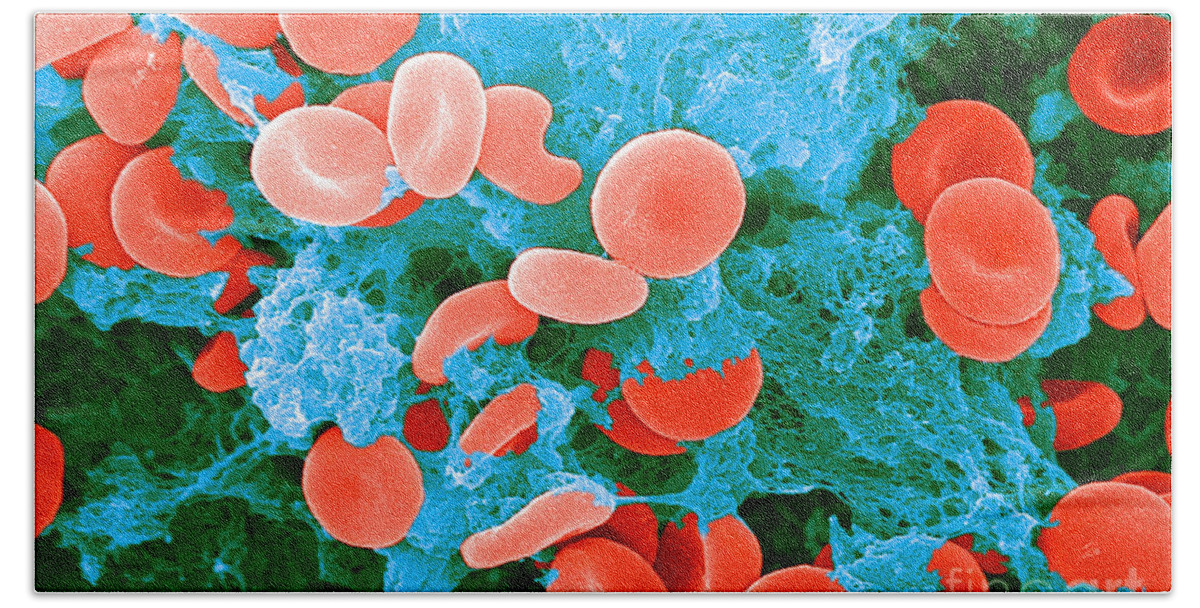 Biology Bath Towel featuring the photograph Red Blood Cells, Sem #7 by Science Source