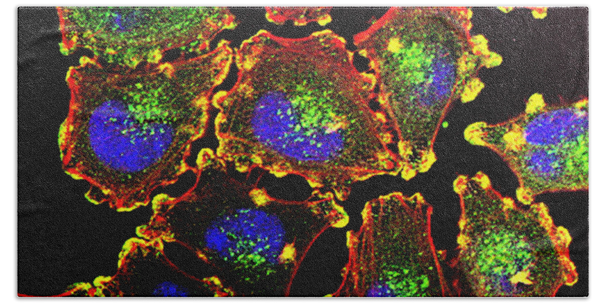 Science Bath Towel featuring the photograph Metastatic Melanoma Cells, Fm by Science Source