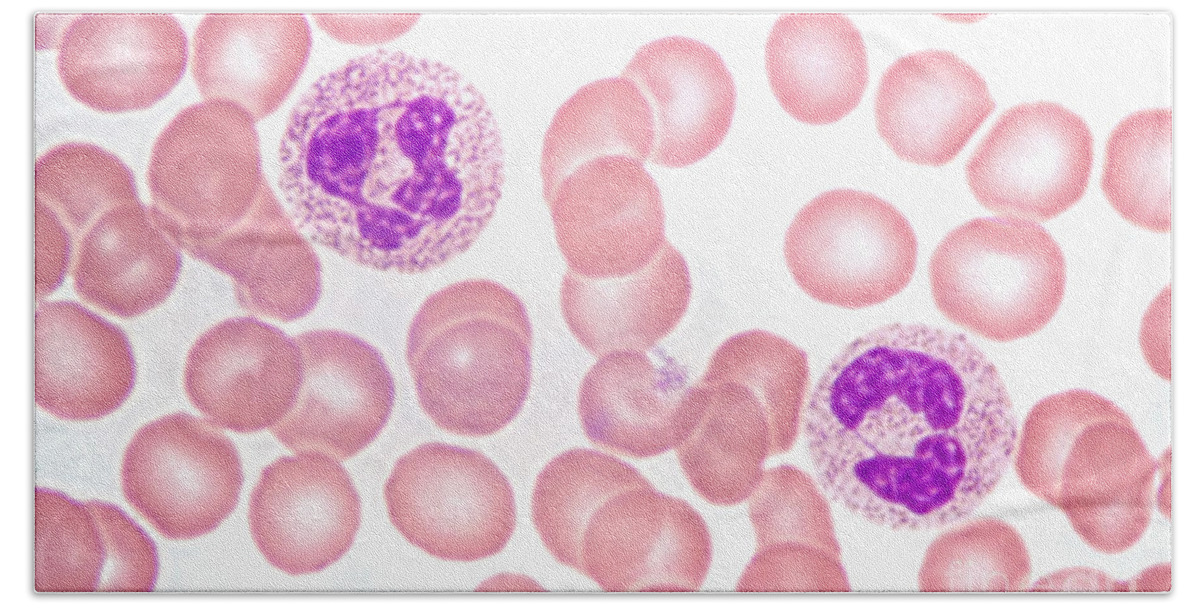 Neutrophil Polymorphs Bath Towel featuring the photograph Neutrophils In Peripheral Blood Smear by M. I. Walker