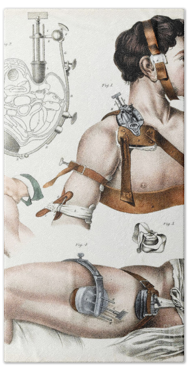 Historic Hand Towel featuring the photograph Operative Surgery, Illustration, 1846 by Wellcome Images