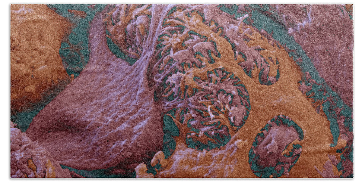 Excretory System Bath Towel featuring the photograph Kidney Glomerulus, Sem #7 by Oliver Meckes EYE OF SCIENCE