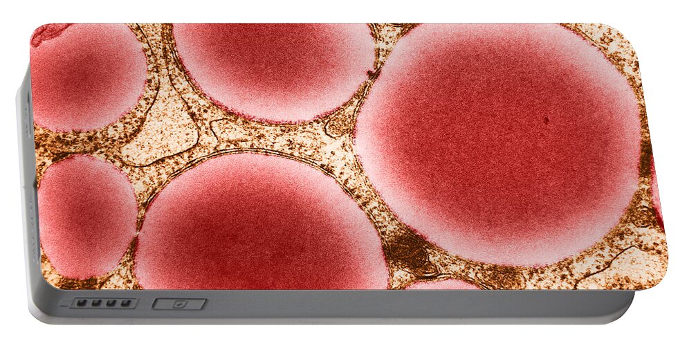 Eukaryote Portable Battery Charger featuring the photograph Lipid Droplets, Tem #2 by David M. Phillips