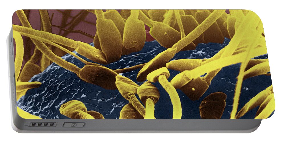 Biology Portable Battery Charger featuring the photograph Sperm On Surface Of Egg, Sem #2 by David M. Phillips