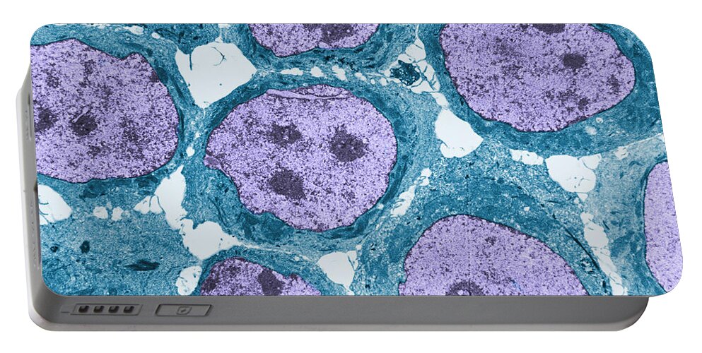 Science Portable Battery Charger featuring the photograph Human Kb Cells Tem #3 by David M. Phillips