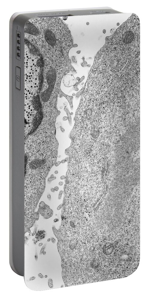 Science Portable Battery Charger featuring the photograph Kb Cell Infected With Adenovirus Tem #3 by David M. Phillips